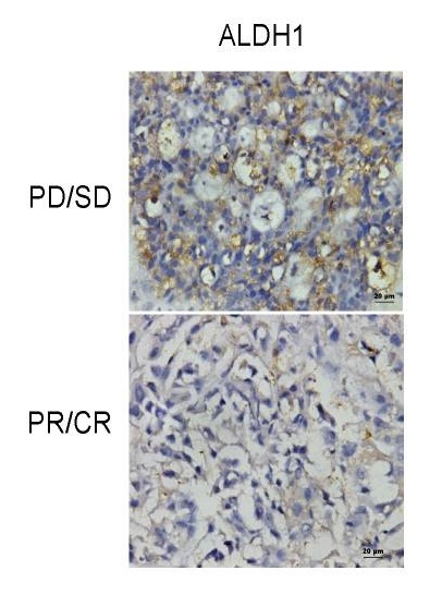 Immunohistochemistry (Formalin/PFA-fixed paraffin-embedded sections) - Anti-ALDH1A1 antibody [EP1933Y] - C-terminal (AB52492), expandable thumbnail