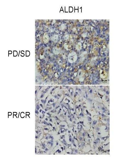 Immunohistochemistry (Formalin/PFA-fixed paraffin-embedded sections) - Anti-ALDH1A1 antibody [EP1933Y] - C-terminal (AB52492)