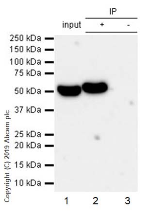 Immunoprecipitation - Anti-ALDH1A1 antibody [EP1933Y] - C-terminal (AB52492), expandable thumbnail