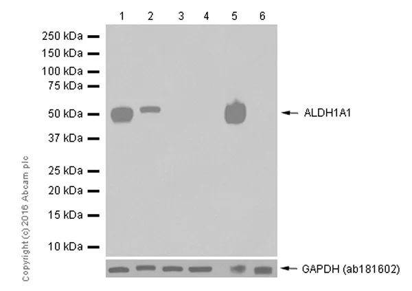 Western blot - Anti-ALDH1A1 antibody [EP1933Y] - C-terminal (AB52492)