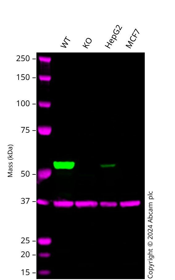 Western blot - Anti-ALDH1A1 antibody [EP1933Y] - C-terminal (ab52492), expandable thumbnail