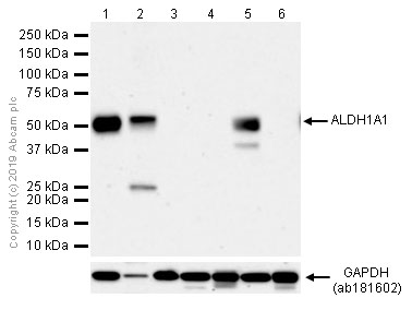 Western blot - Anti-ALDH1A1 antibody [EP1933Y] - C-terminal (AB52492), expandable thumbnail