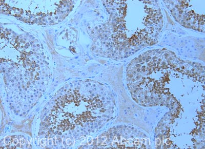 Immunohistochemistry (Formalin/PFA-fixed paraffin-embedded sections) - Anti-ALDH1A2 antibody (AB75674)