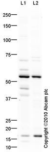 Western blot - Anti-ALDH1A2 antibody (AB75674)