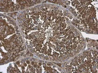 Immunohistochemistry (Formalin/PFA-fixed paraffin-embedded sections) - Anti-ALDH1A2 antibody (AB96060)