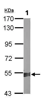 Western blot - Anti-ALDH1A2 antibody (AB96060)