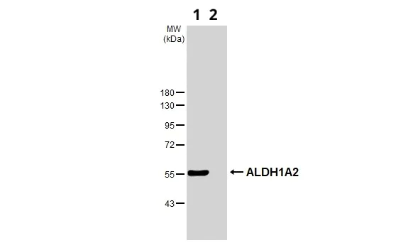 Western blot - Anti-ALDH1A2 antibody (AB96060)