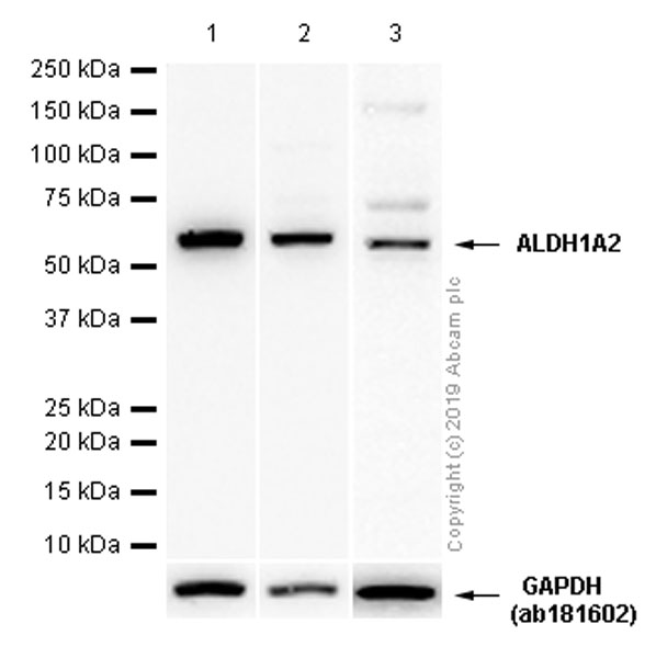 Western blot - Anti-ALDH1A2 antibody [EPR9370] (AB156019)