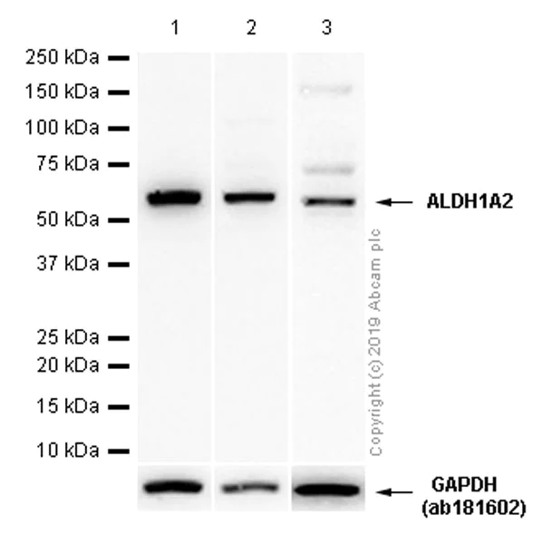 Western blot - Anti-ALDH1A2 antibody [EPR9370] - BSA and Azide free (AB249258)