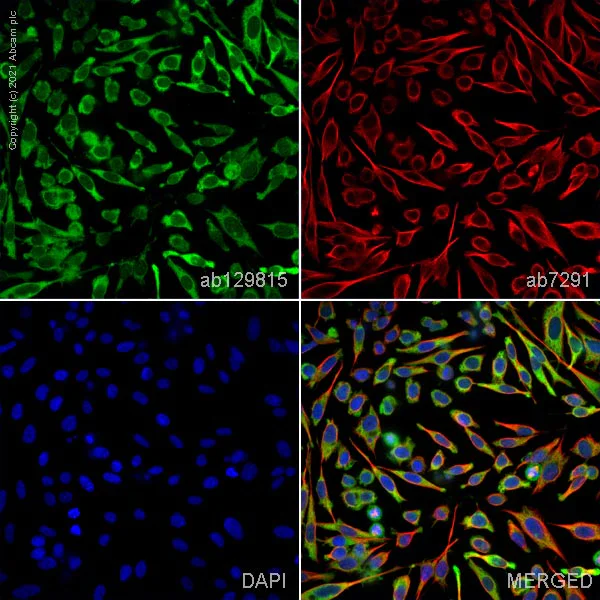 Immunocytochemistry/ Immunofluorescence - Anti-ALDH1A3 antibody (AB129815)