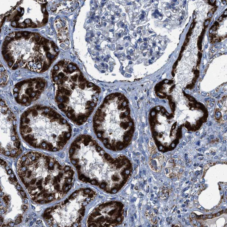 Immunohistochemistry (Formalin/PFA-fixed paraffin-embedded sections) - Anti-ALDH1B1 antibody (AB246928)