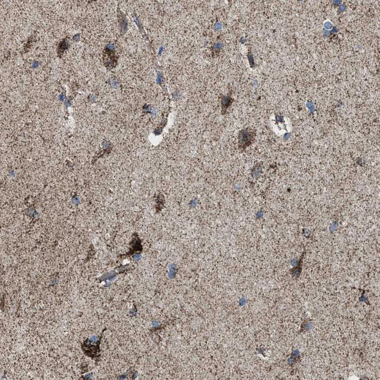 Immunohistochemistry (Formalin/PFA-fixed paraffin-embedded sections) - Anti-ALDH1B1 antibody (AB246928)