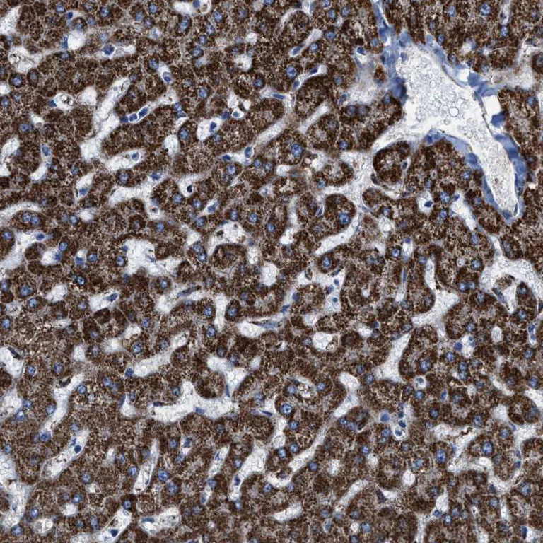 Immunohistochemistry (Formalin/PFA-fixed paraffin-embedded sections) - Anti-ALDH1B1 antibody (AB246928)