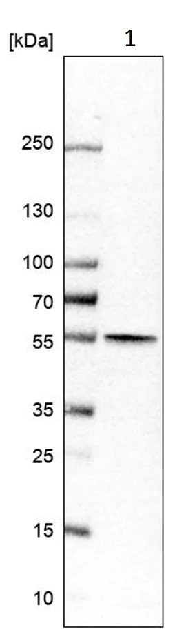 Western blot - Anti-ALDH1B1 antibody (AB246928)