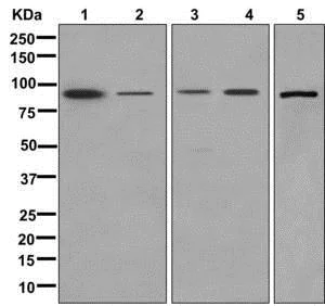 Western blot - Anti-ALDH1L1 + ALDH1L2 antibody [EPR12743(B)] - Astrocyte Marker (AB177463)