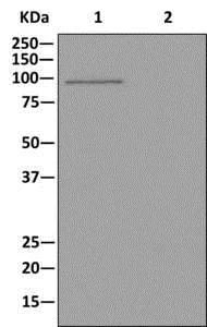 Western blot - Anti-ALDH1L1 + ALDH1L2 antibody [EPR12743(B)] - Astrocyte Marker (AB177463)
