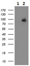 Western blot - Anti-ALDH1L1 antibody [2A6] - Astrocyte Marker (AB231018)