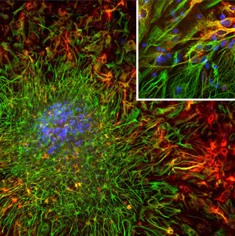 Immunocytochemistry - Anti-ALDH1L1 antibody [2E7] - Astrocyte Marker (AB277623)
