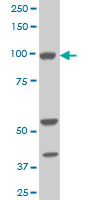 Western blot - Anti-ALDH1L1 antibody [3E9] - Astrocyte Marker (AB56777), expandable thumbnail