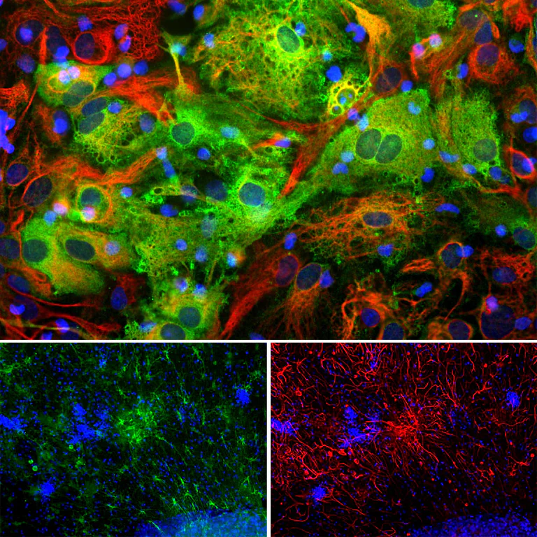 Immunocytochemistry/ Immunofluorescence - Anti-ALDH1L1 antibody [4A12] - Astrocyte Marker (AB315197)