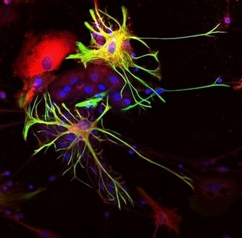 Anti-ALDH1L1 antibody - Astrocyte Marker (ab190298) | Abcam