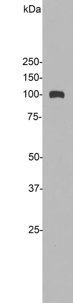 Western blot - Anti-ALDH1L1 antibody - Astrocyte Marker (AB190298)