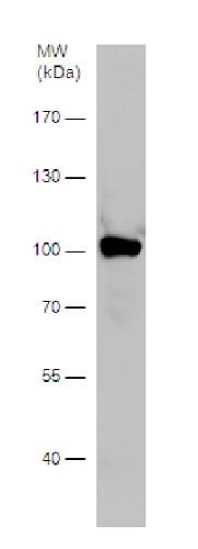 Western blot - Anti-ALDH1L1 antibody - Astrocyte Marker (AB226954), expandable thumbnail