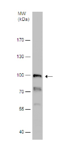 Western blot - Anti-ALDH1L1 antibody - Astrocyte Marker (AB226954), expandable thumbnail