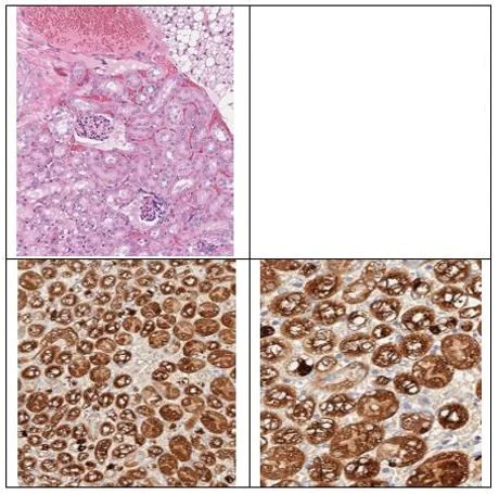 Immunohistochemistry (Formalin/PFA-fixed paraffin-embedded sections) - Anti-ALDH1L1 antibody - Astrocyte Marker (AB235197)