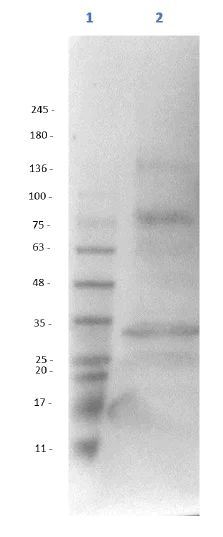 Western blot - Anti-ALDH1L1 antibody - Astrocyte Marker (AB235197)