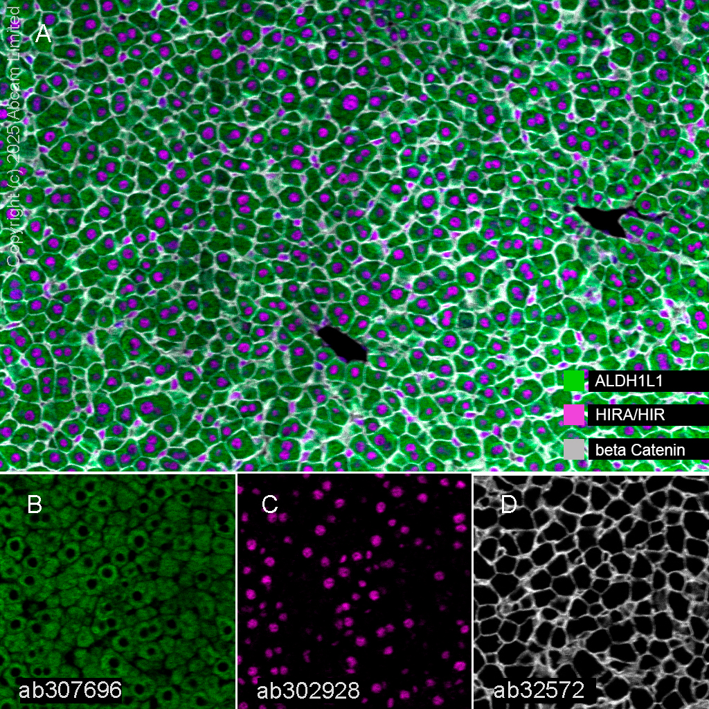 Multiplex immunohistochemistry - Anti-ALDH1L1 antibody [EPR25443-103] - Astrocyte Marker (ab307696), expandable thumbnail