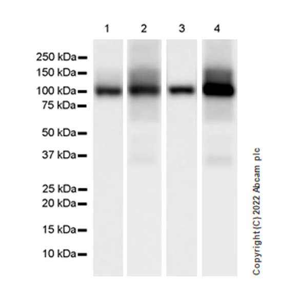 Western blot - Anti-ALDH1L1 antibody [EPR25443-103] - Astrocyte Marker (AB307696)