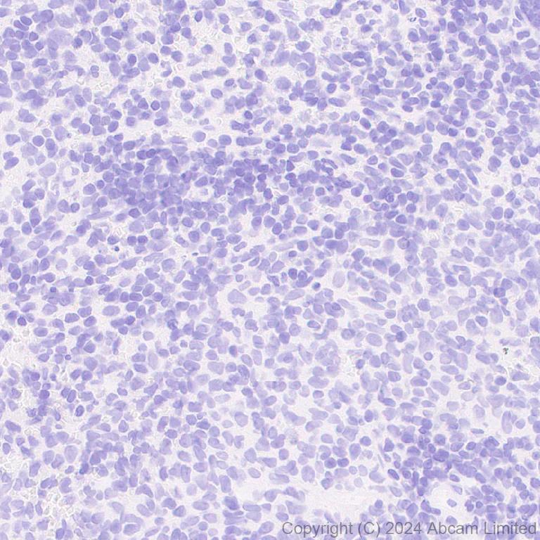 Immunohistochemistry (Formalin/PFA-fixed paraffin-embedded sections) - Anti-ALDH1L1 antibody [RM1230] - Astrocyte Marker (AB321905)