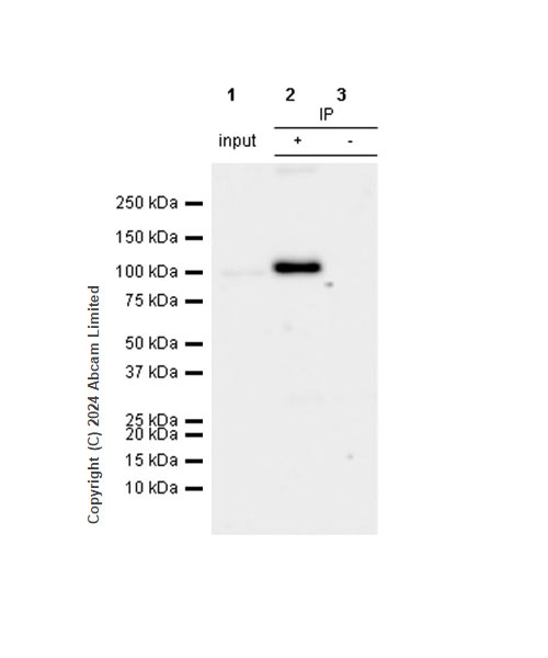 Immunoprecipitation - Anti-ALDH1L1 antibody [RM1230] - Astrocyte Marker (ab321905), expandable thumbnail