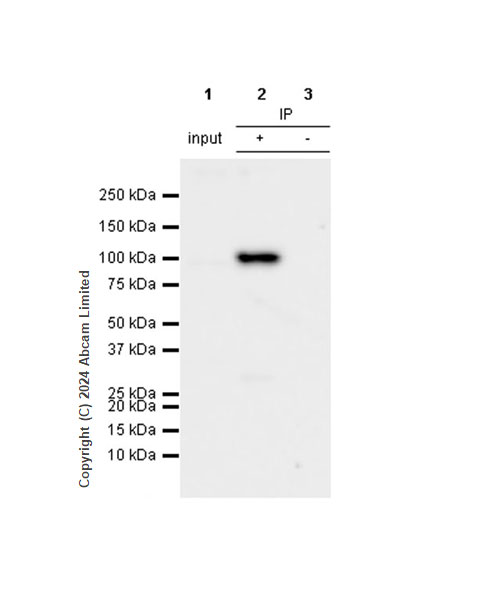Immunoprecipitation - Anti-ALDH1L1 antibody [RM1230] - Astrocyte Marker (AB321905), expandable thumbnail