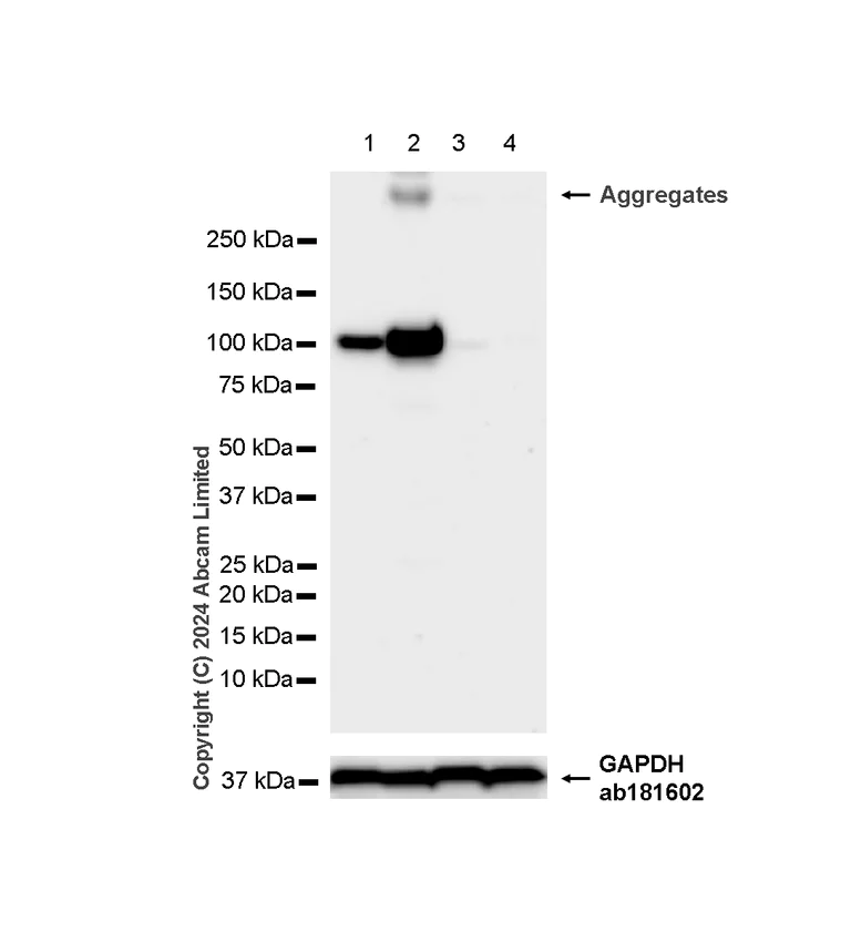 Western blot - Anti-ALDH1L1 antibody [RM1230] - Astrocyte Marker (AB321905)