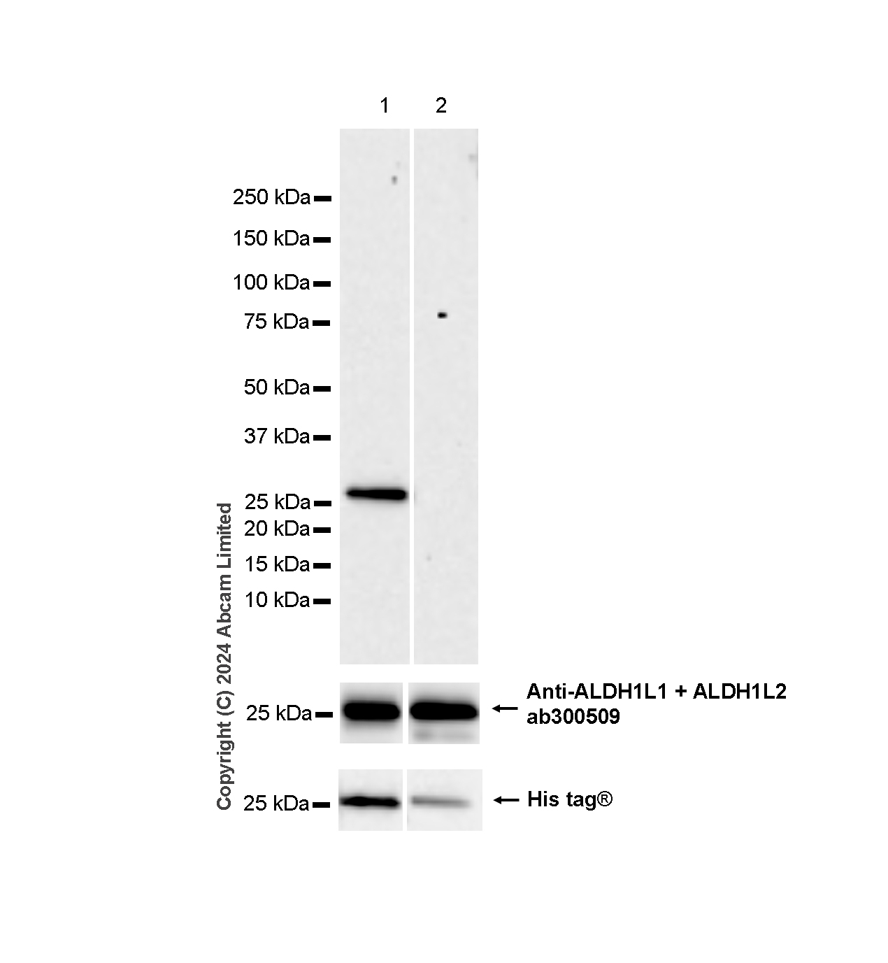 Western blot - Anti-ALDH1L1 antibody [RM1230] - Astrocyte Marker (AB321905), expandable thumbnail