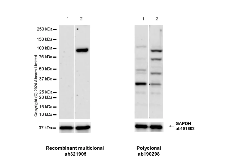 Western blot - Anti-ALDH1L1 antibody [RM1230] - Astrocyte Marker (AB321905)