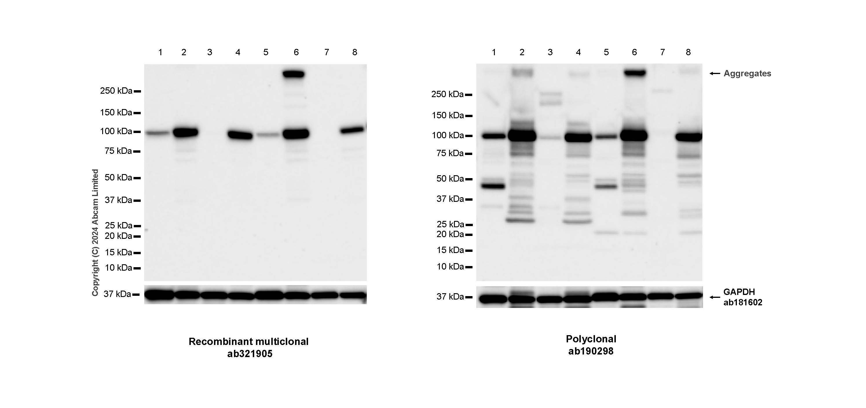 Western blot - Anti-ALDH1L1 antibody [RM1230] - Astrocyte Marker (ab321905), expandable thumbnail