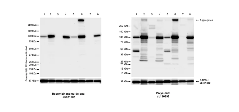 Western blot - Anti-ALDH1L1 antibody [RM1230] - Astrocyte Marker (AB321905)