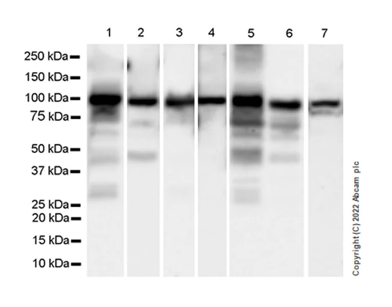 Western blot - Anti-ALDH1L1+ALDH1L2 antibody [EPR25443-54] - BSA and Azide free (AB300510)