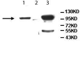 Western blot - Anti-ALDH1L2 antibody (AB113496)