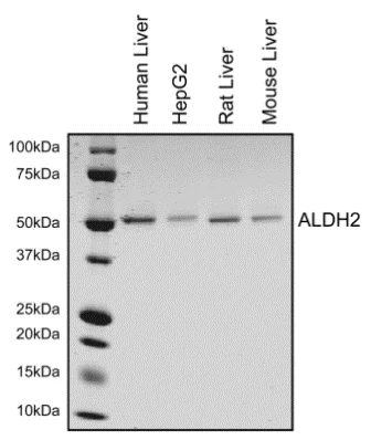Immunoprecipitation - Anti-ALDH2 antibody [9A10AF10] (AB110311)