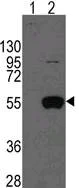 Western blot - Anti-ALDH2 antibody (AB115198)
