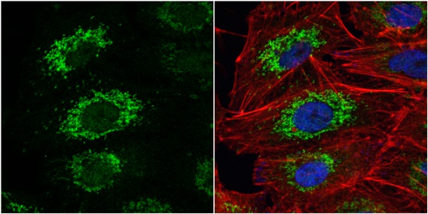 Immunocytochemistry/ Immunofluorescence - Anti-ALDH2 antibody (AB227021), expandable thumbnail