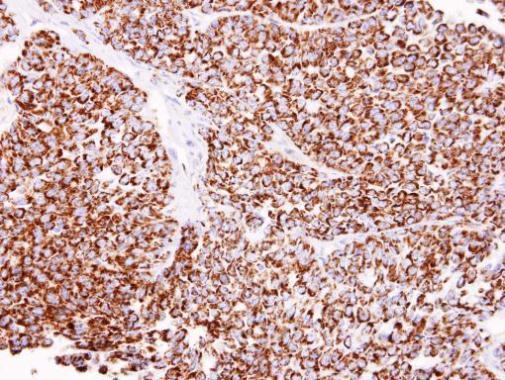 Immunohistochemistry (Formalin/PFA-fixed paraffin-embedded sections) - Anti-ALDH2 antibody (ab227021), expandable thumbnail