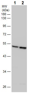 Western blot - Anti-ALDH2 antibody (AB227021), expandable thumbnail