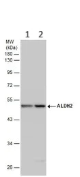Western blot - Anti-ALDH2 antibody (AB227021)