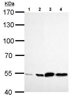 Western blot - Anti-ALDH2 antibody (AB227021), expandable thumbnail