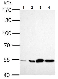 Western blot - Anti-ALDH2 antibody (AB227021)